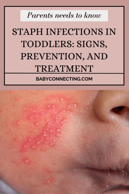 Staph Infections in Toddlers: Signs, Prevention, and Treatment