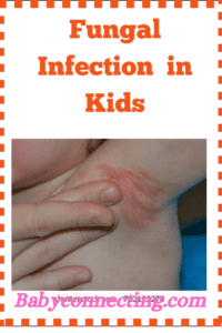Fungal Infection in Kids